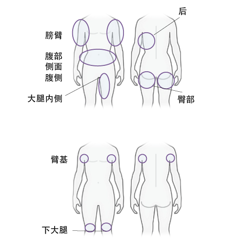 Upper arm, abdomen, inner thighs, sides, upper thighs